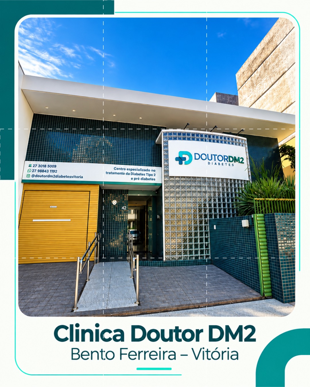 M&eacute;todo reverse para Diabetes tipo 2 e pr&eacute; diabetes